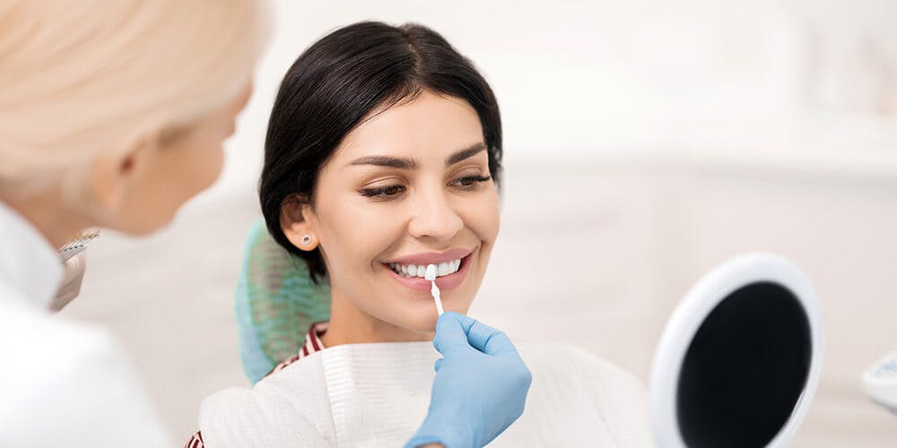 Dental Veneers